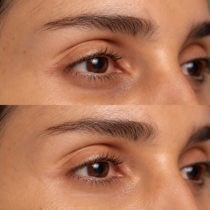 Awake Eye Patches